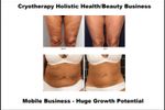 Cryotherapy Cool Sculpting - Fat Freezing Niche - Mobile Business run anywhere!